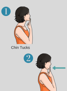 Chin Tucks