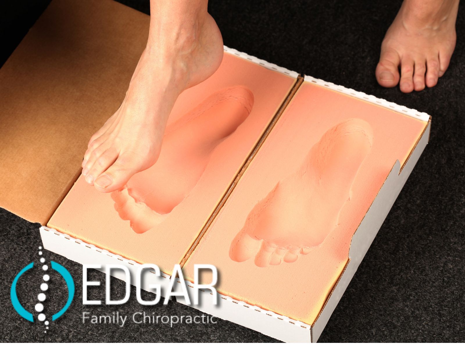 Mold for Custom Orthotics.