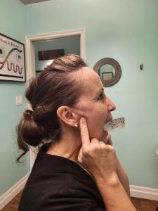 Dr. Maja measuring how wide she can open her jaw.